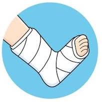 گچ گیری و باز کردن گچ